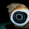 annular eye